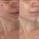 Supernatural Blemish Face Serum