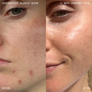 Supernatural Blemish Face Serum