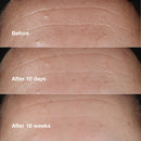 Smart Clinical Repair Wrinkle Correcting Serum