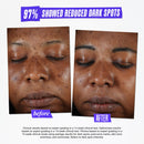 Clearly Corrective Dark Spot Solution