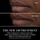 The Lip Treatment