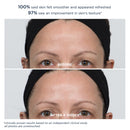 PowerGlow Peel Extra Strength - 20 Treatments