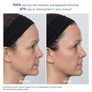 PowerGlow Peel Extra Strength