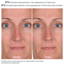 PowerGlow Peel - 30 Treatments