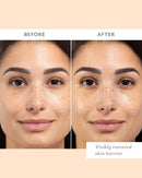 Skin Remedy Barrier-Boosting Sheet Mask