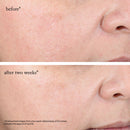 15% Glycolic Acid Overnight Glow Peel