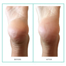 PoshPeel Pedi Cure