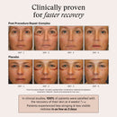 Pre & Post Procedure Prep