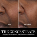 The Concentrate