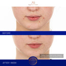 The Retinol Serum