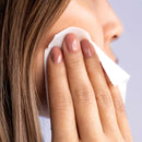 Perfect Peel - 10 Treatments