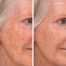 Enlighten Plus Under-Eye Concealer