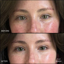 Revitalize Hydra Concealer